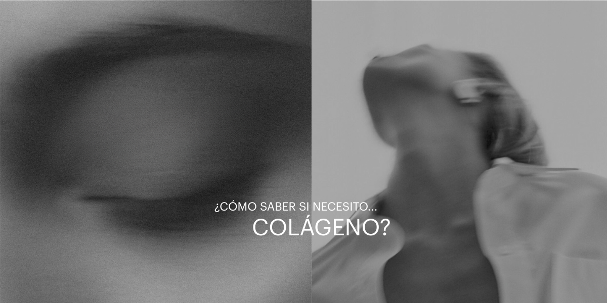 ¿Necesitas colágeno?